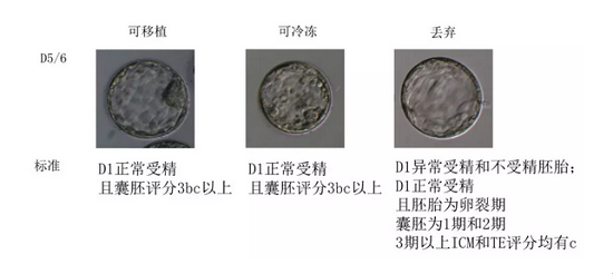 D5/6可移植、可冷冻和丢弃胚胎的标准